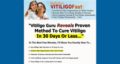 Desktop Screenshot of howtocurevitiligofast.com